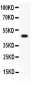 Anti-CSK Picoband Antibody